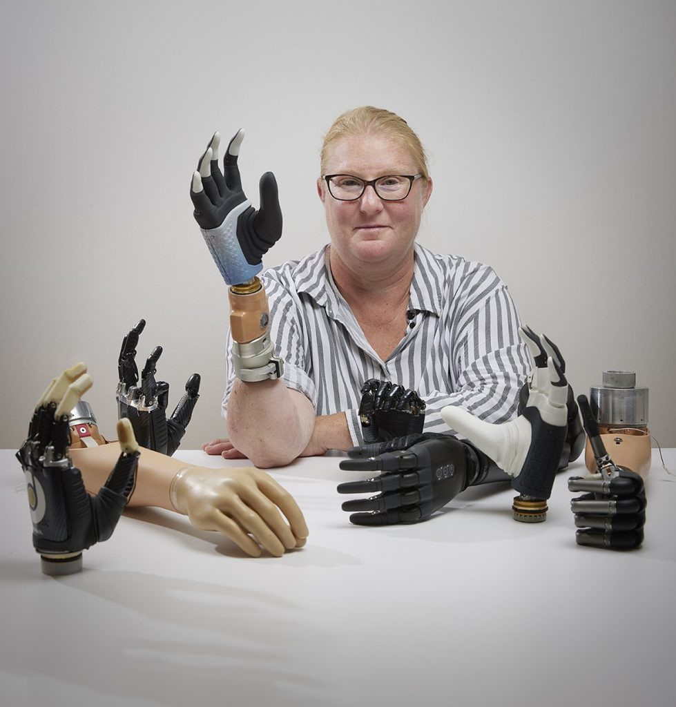 mano robotica
