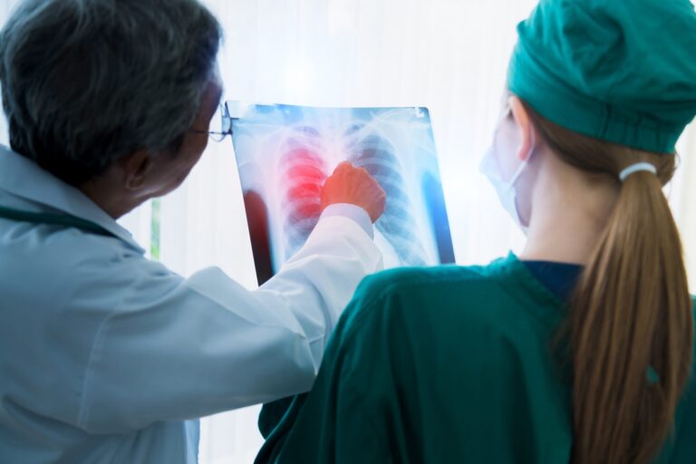 Fibrosi polmonare, modello per battere i ritardi diagnostici